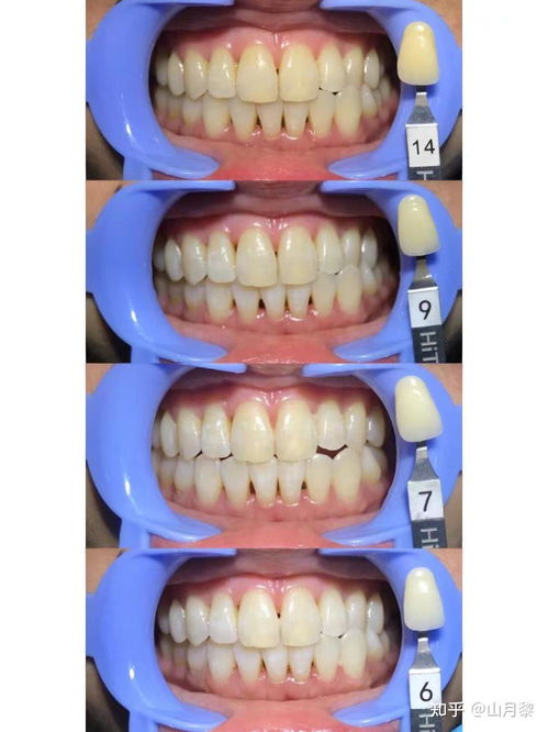 牙科醫(yī)生眼中真正有效的美白及口腔衛(wèi)生用品